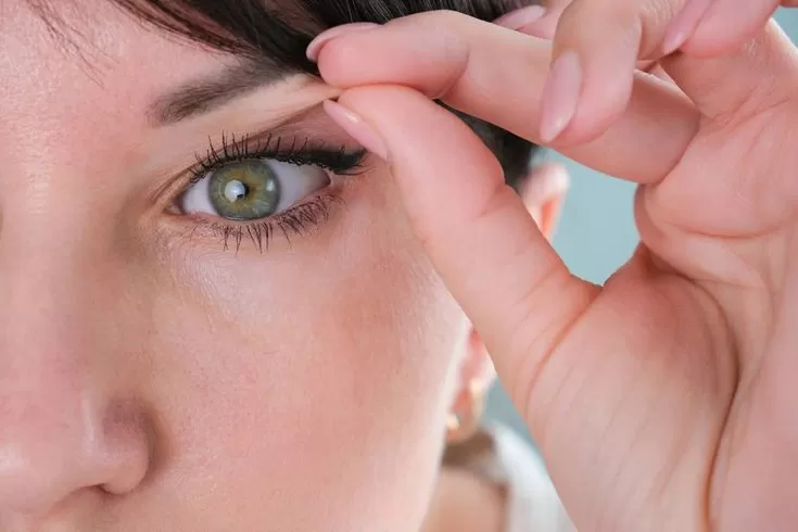 Sụp mí là gì? Nguyên nhân, phân loại và cách điều trị hiệu quả